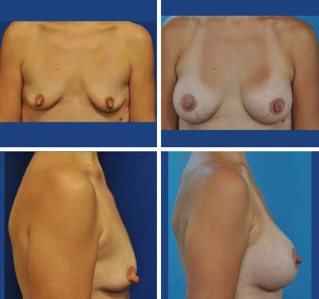 24-Before-and-After