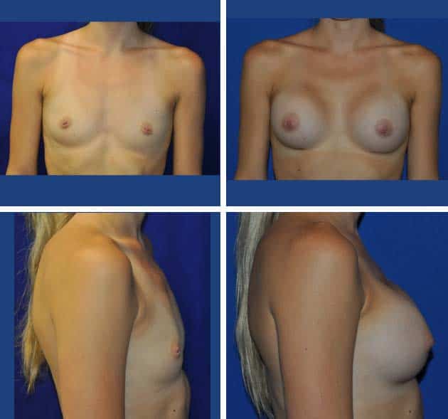 33-Before-and-After