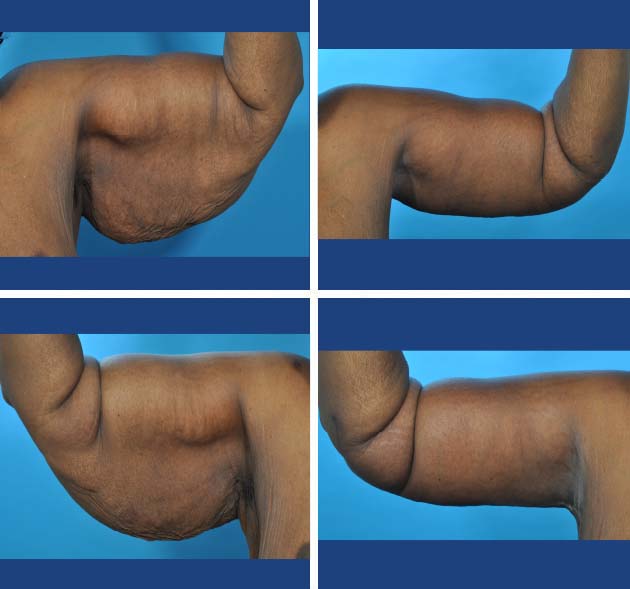 47-Before-and-After