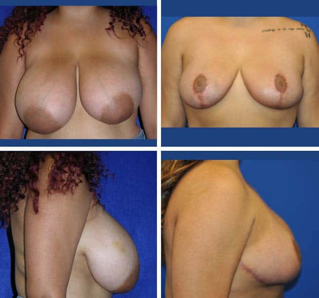 5-Before-and-After