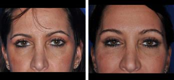 brow-94574-348x160-1
